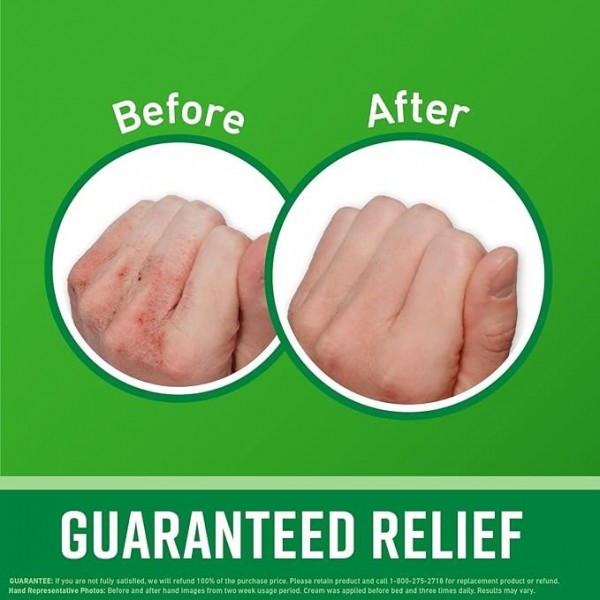 O'Keeffe's Working Hands Hand Cream, Relieves and Repairs Extremely Dry Hands, 85 ml *2